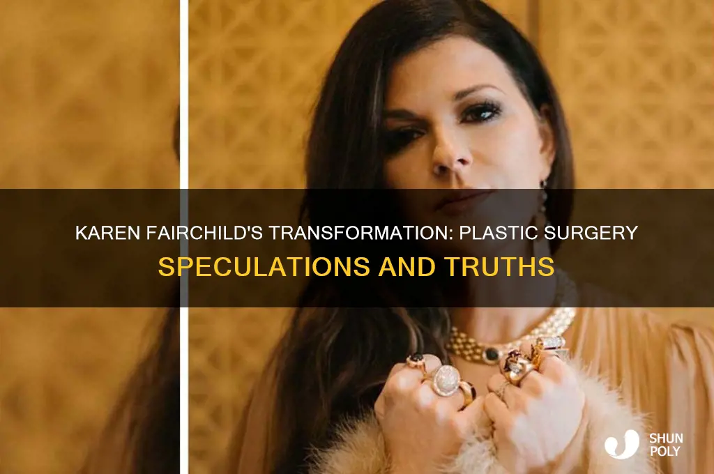did karen fairchild have plastic surgery