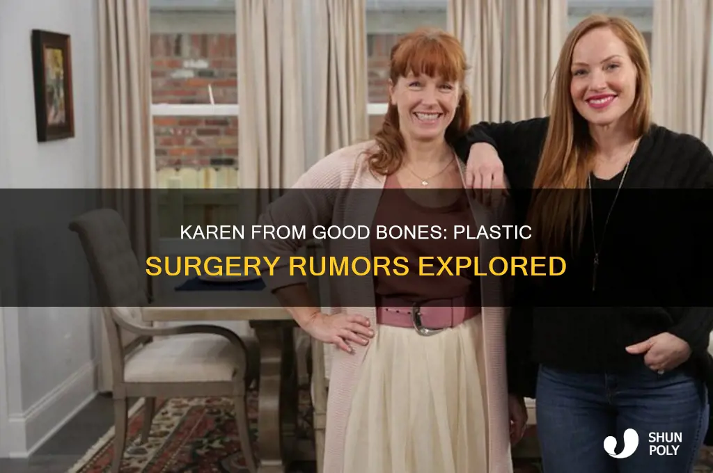 did karen from good bones have plastic surgery