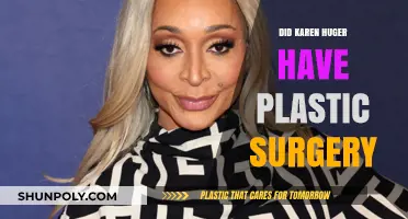 Karen Huger Plastic Surgery: Fact-Checking the Rumors and Speculations