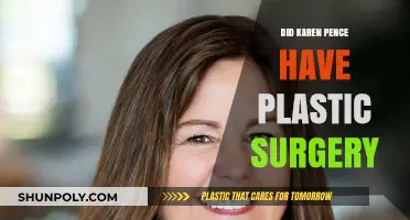 Karen Pence Plastic Surgery: Fact-Checking the Rumors and Speculations