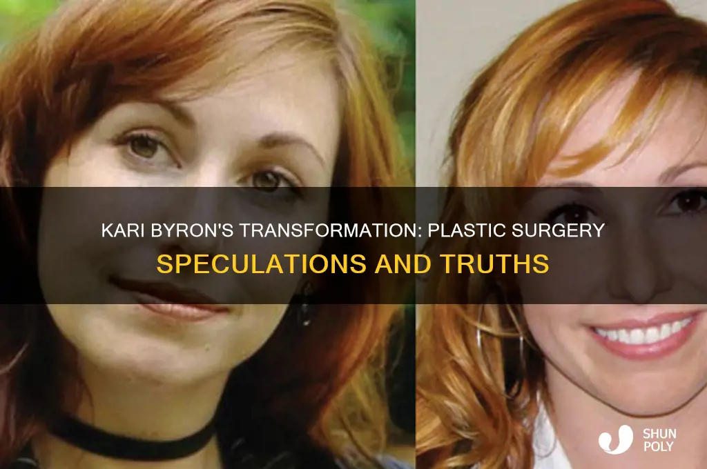 did kari bryon get plastic surgery