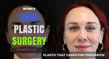 Did Karli B Undergo Plastic Surgery? Unveiling the Truth