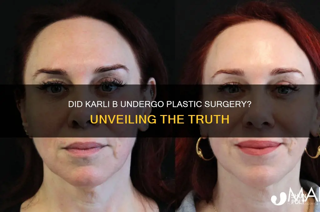 did karli b have plastic surgery