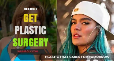 Karol G Plastic Surgery: Fact-Checking the Rumors and Speculations