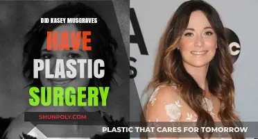Kasey Musgraves Plastic Surgery Rumors: Fact or Fiction?