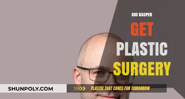 Kasper's Transformation: Plastic Surgery Rumors and the Truth Behind Them