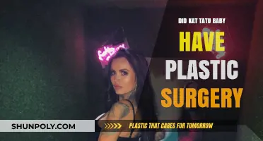 Did Kat Tatu Baby Undergo Plastic Surgery? Unveiling the Truth