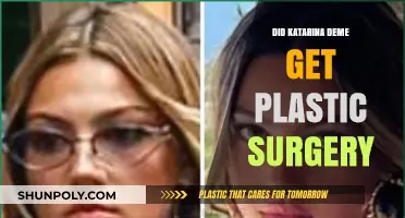 Katarina Deme's Transformation: Plastic Surgery Speculations and Truths
