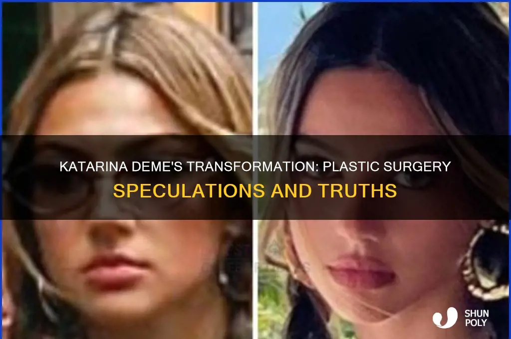 did katarina deme get plastic surgery