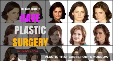 Kate Beckett's Transformation: Plastic Surgery Rumors Explored and Debunked
