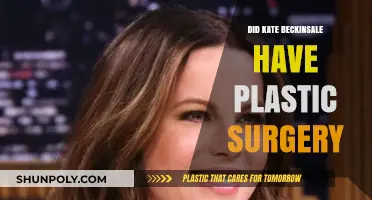 Kate Beckinsale's Transformation: Plastic Surgery Rumors Explored