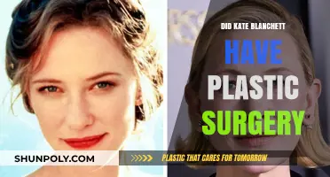 Kate Blanchett Plastic Surgery: Fact-Checking the Rumors and Speculations