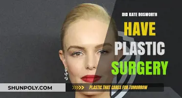 Kate Bosworth's Transformation: Plastic Surgery Rumors Explored and Debunked
