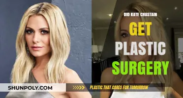 Kate Chastain Plastic Surgery: Fact-Checking the Rumors and Speculations