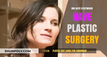 Kate Fleetwood's Transformation: Plastic Surgery Speculations and Truths
