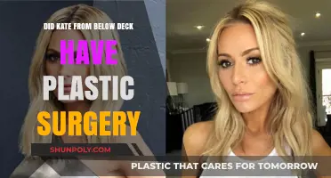Kate Chastain's Transformation: Plastic Surgery Rumors on Below Deck
