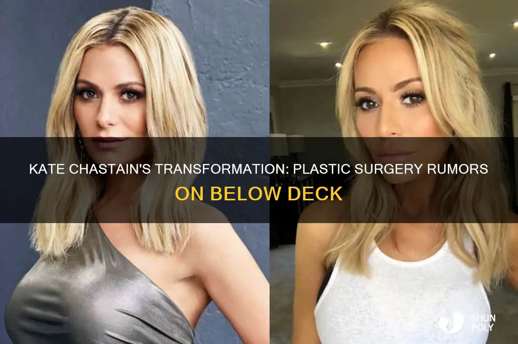 did kate from below deck have plastic surgery
