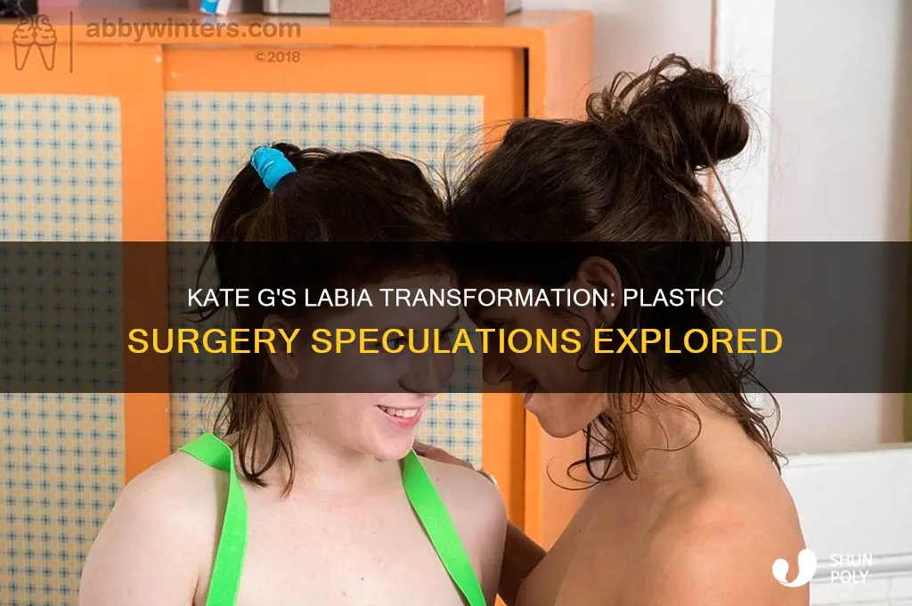 did kate g have plastic surgery on her labia