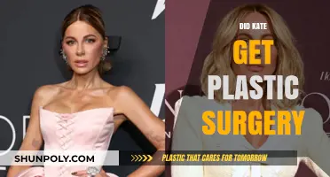 Kate's Transformation: Unveiling the Truth About Plastic Surgery Speculations