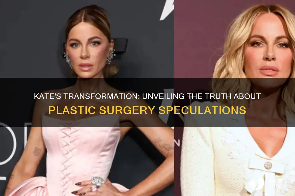 did kate get plastic surgery