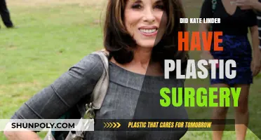 Kate Linder's Transformation: Plastic Surgery Speculations and Truths