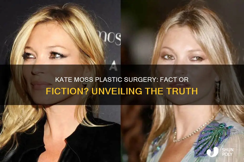 did kate moss get plastic surgery