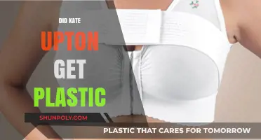 Kate Upton Plastic Surgery Rumors: Fact or Fiction?
