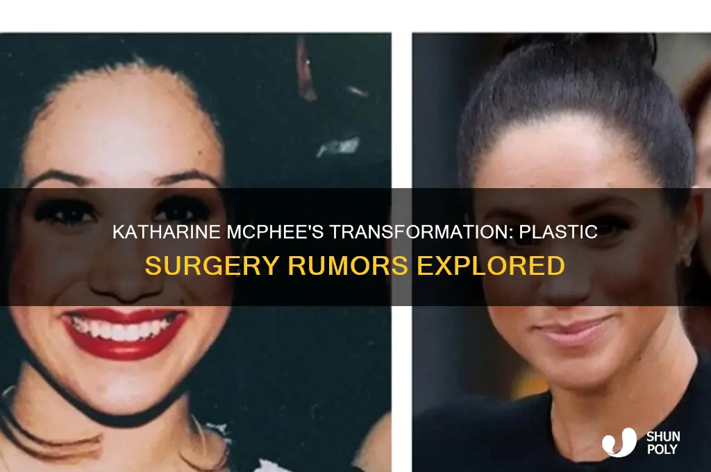 did katharine mcphee get plastic surgery