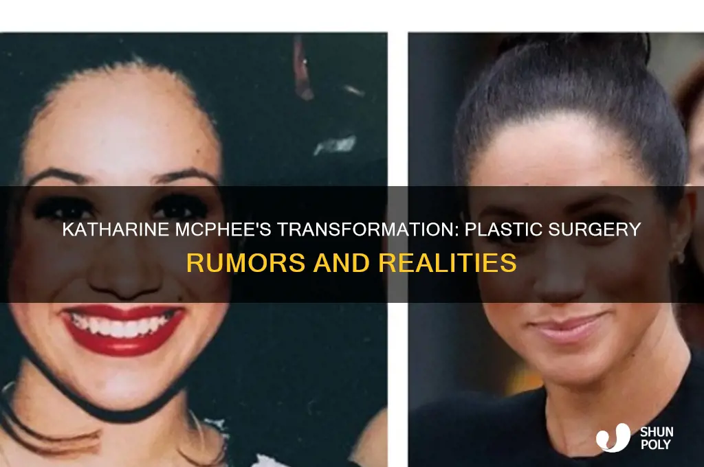did katharine mcphee have plastic surgery