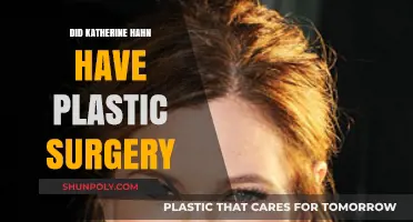 Katherine Hahn's Transformation: Plastic Surgery Speculations and Truths