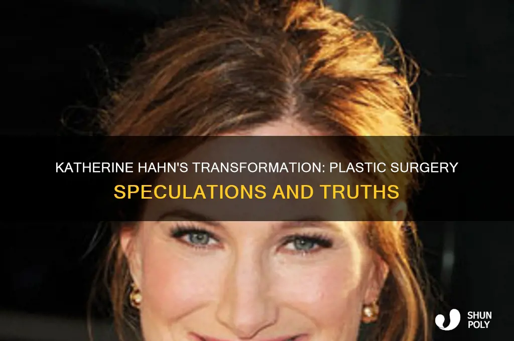 did katherine hahn have plastic surgery