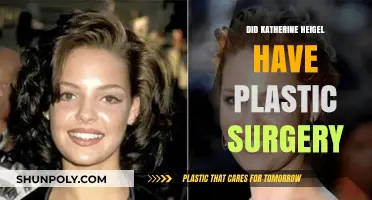 Katherine Heigl's Transformation: Plastic Surgery Rumors and Reality Revealed