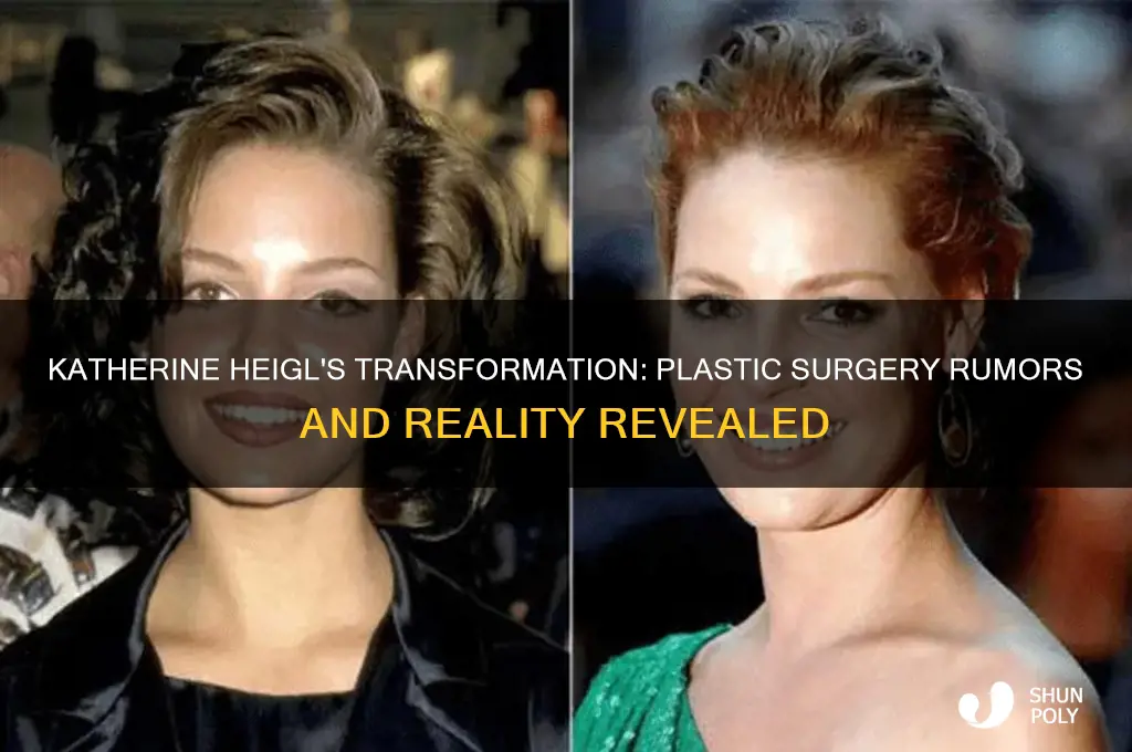 did katherine heigel have plastic surgery