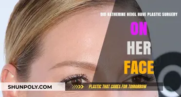 Katherine Heigl's Facial Transformation: Plastic Surgery Speculations Explored
