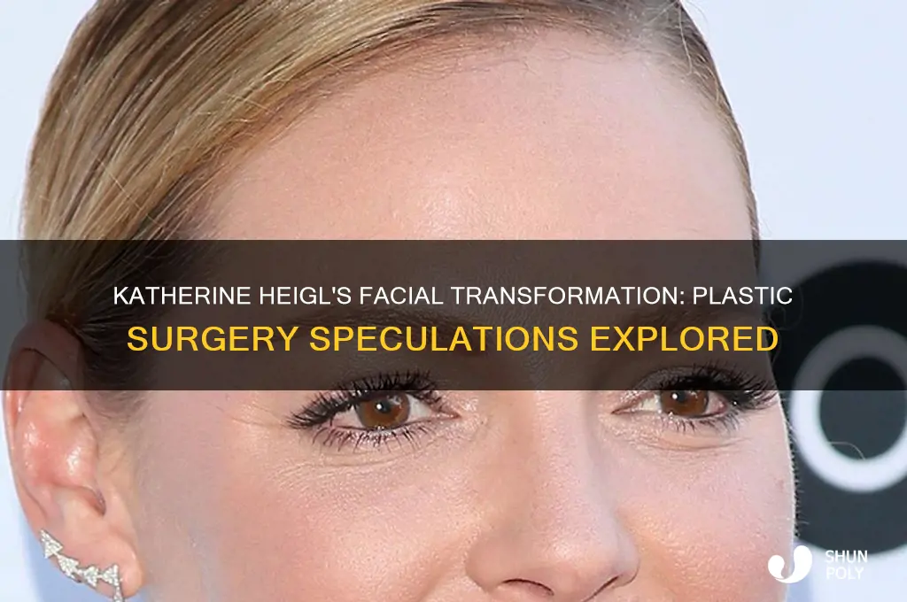 did katherine heigl have plastic surgery on her face