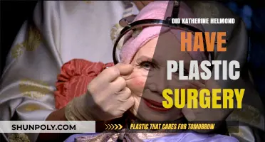 Katherine Helmond's Transformation: Plastic Surgery Rumors Explored