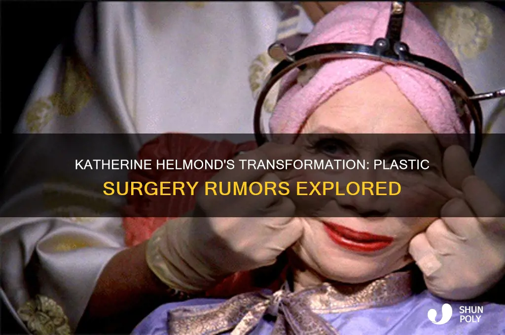 did katherine helmond have plastic surgery