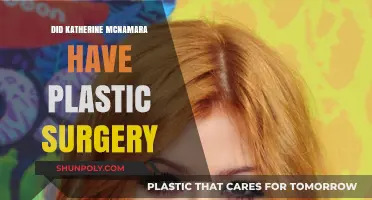 Katherine McNamara's Transformation: Plastic Surgery Rumors Explored