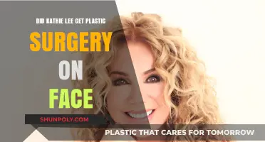 Kathie Lee's Face Transformation: Plastic Surgery Speculations Explored