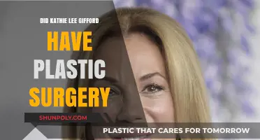 Kathie Lee Gifford's Transformation: Plastic Surgery Speculations Explored