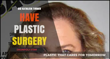 Kathleen Turner's Transformation: Plastic Surgery Speculations and Truths