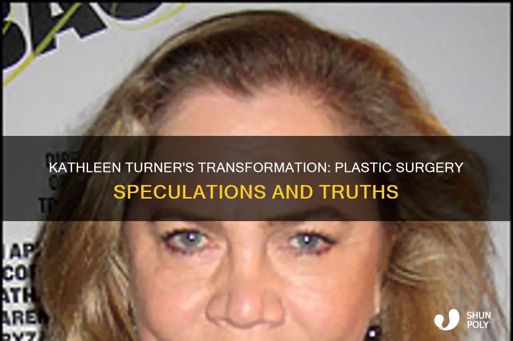 did kathleen turner have plastic surgery