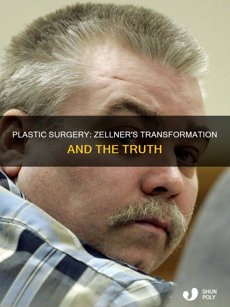 did kathleen zellner have plastic suegery