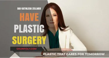 Kathleen Zellner Plastic Surgery: Fact-Checking the Rumors and Speculations