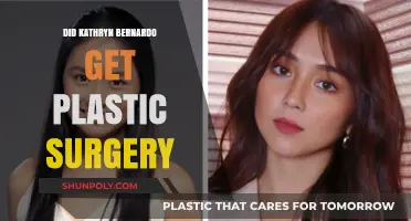 Kathryn Bernardo Plastic Surgery: Fact-Checking the Rumors and Speculations