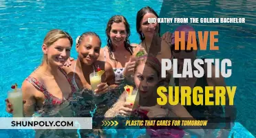 Kathy's Transformation: Plastic Surgery Rumors on The Golden Bachelor
