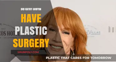 Kathy Griffin's Transformation: Plastic Surgery Rumors and Reality Revealed