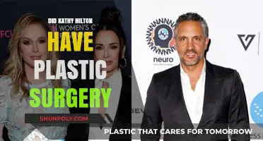 Kathy Hilton's Transformation: Plastic Surgery Speculations and Truths Revealed