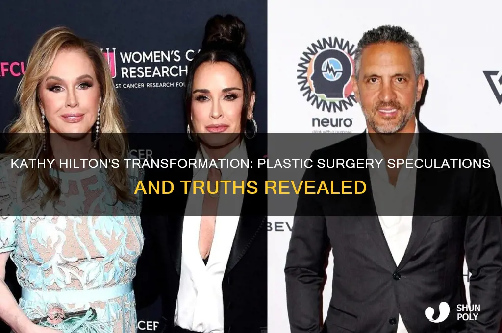 did kathy hilton have plastic surgery