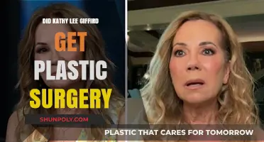 Kathy Lee Gifford's Transformation: Plastic Surgery Speculations Explored
